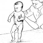 Что делать при гипертонусе мышц у новорожденных